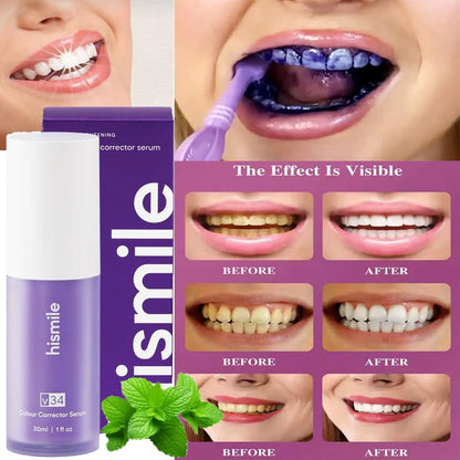 V34 Teeth Whitening Serum - (IMPORTED)